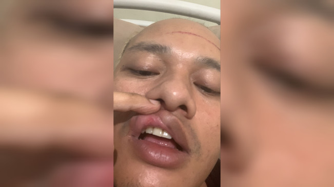 Kondisi Muhammad Irfan saat ini. [Dok. Pribadi]